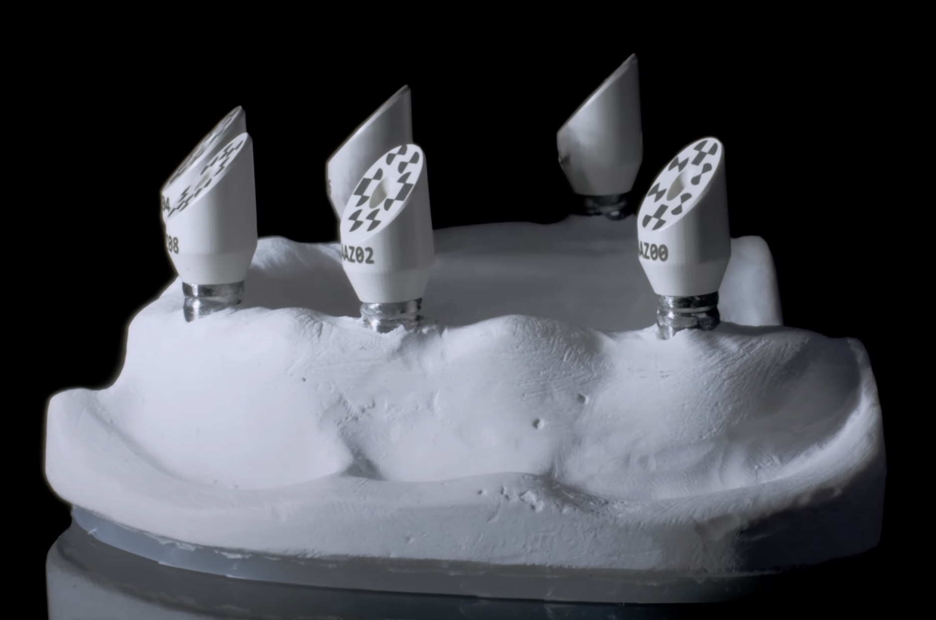 model with scan bodies